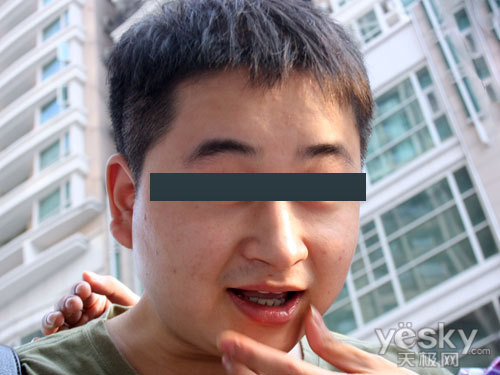 Ҳ뿴 ӽ̫֮ƪ